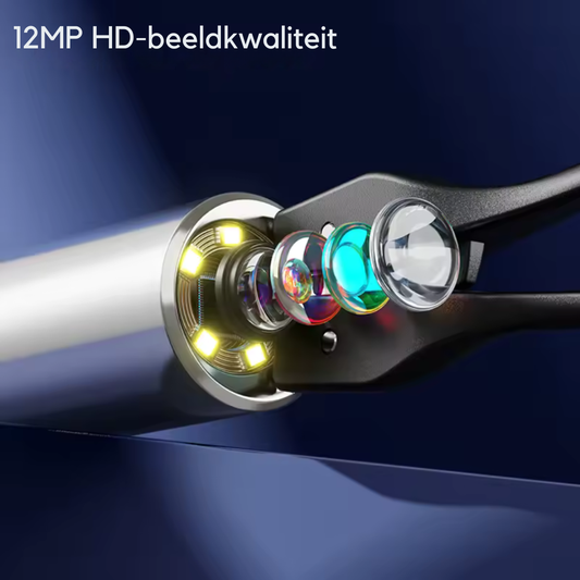 Slimme Oorreiniger met Camera